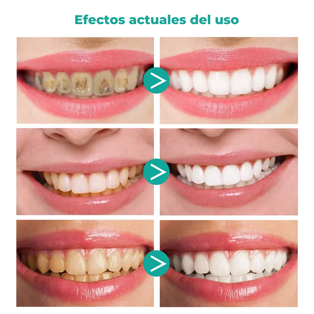 ¡Ilumina tu sonrisa con Aliver! ✨🦷